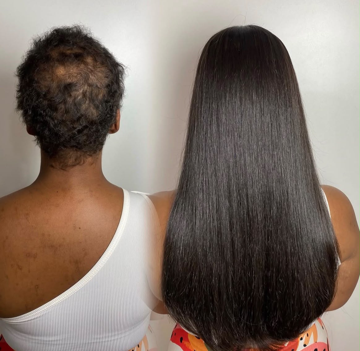 Antes e Depois 1