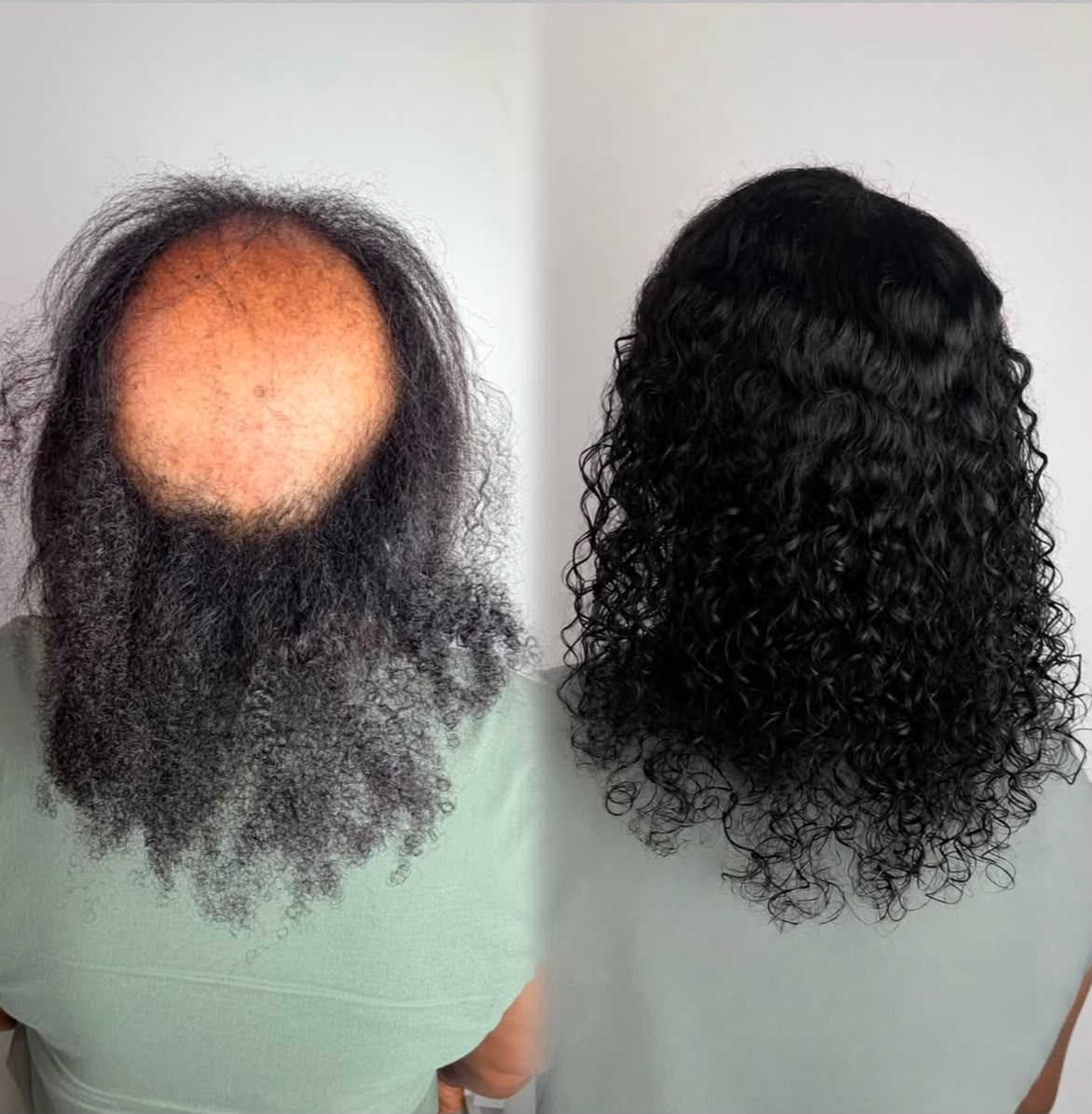 Antes e Depois 2